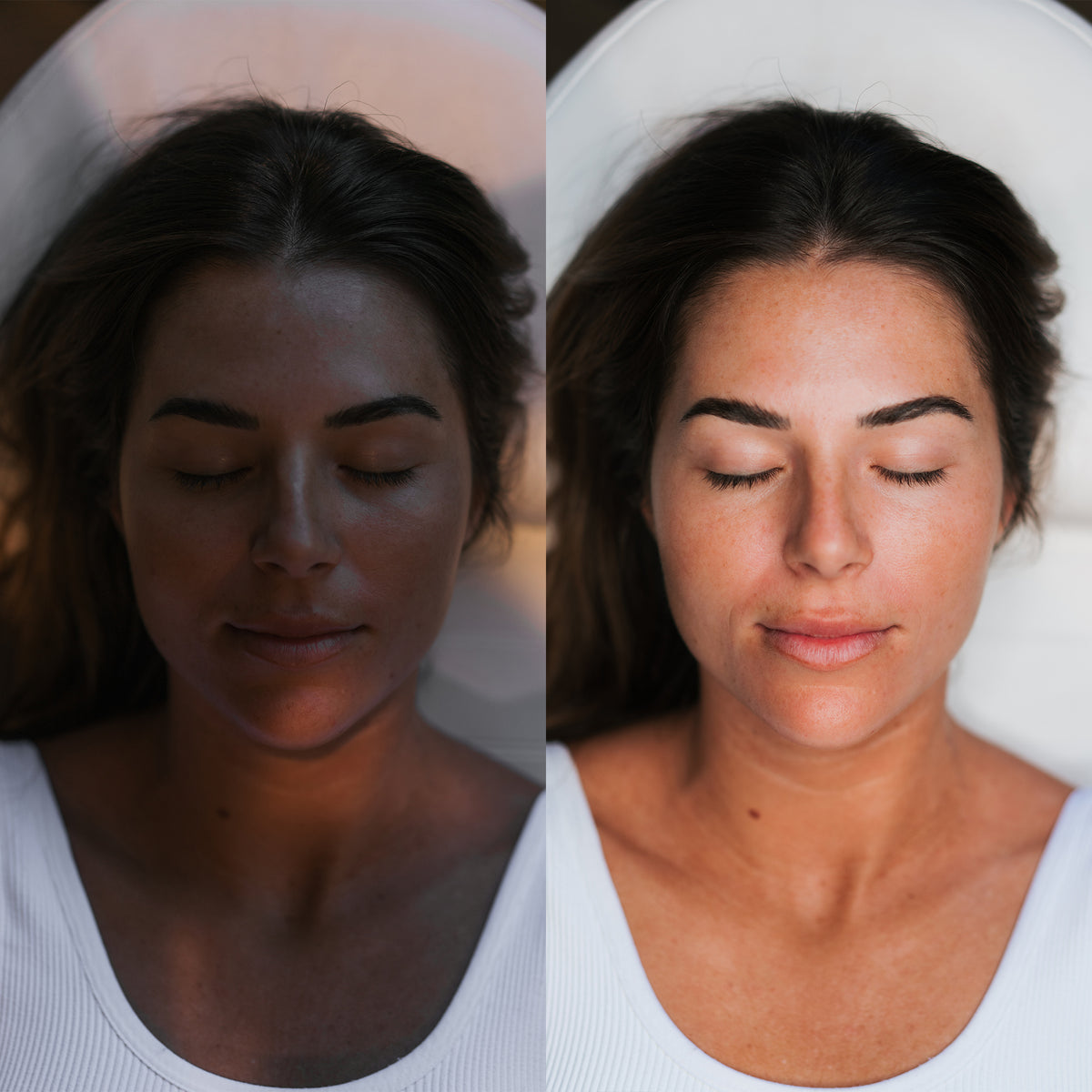 A side-by-side before and after comparison of a woman's face, showing a dramatic improvement in skin tone and texture under bright, clean lighting.
